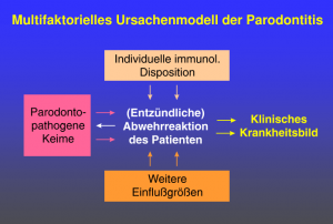 Multifaktorielles Ursachenmodell der Parodontitis